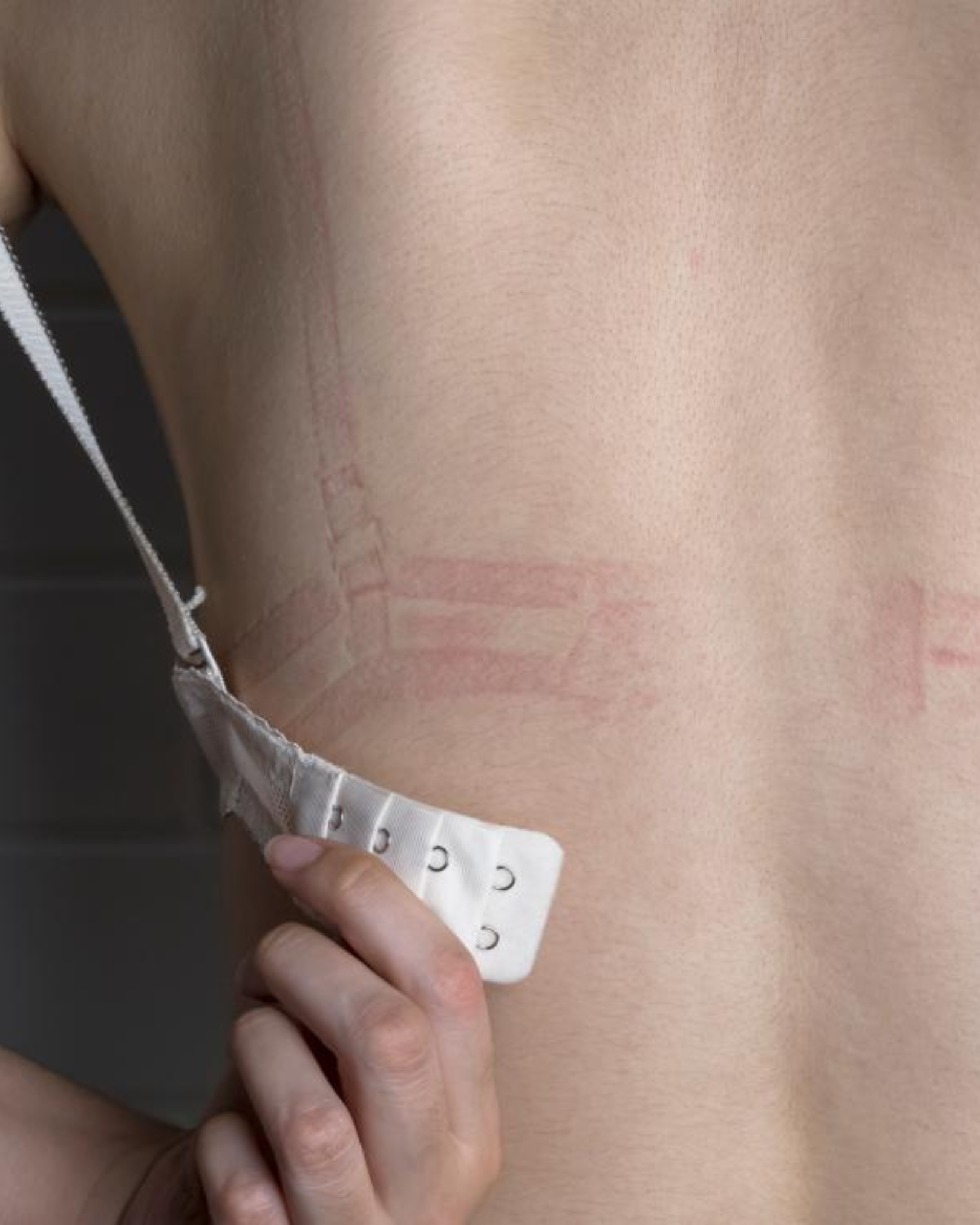 Costados y axilas marcadas